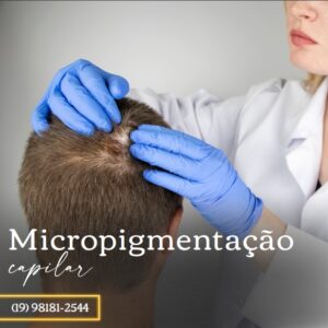 micropigmentação capilar